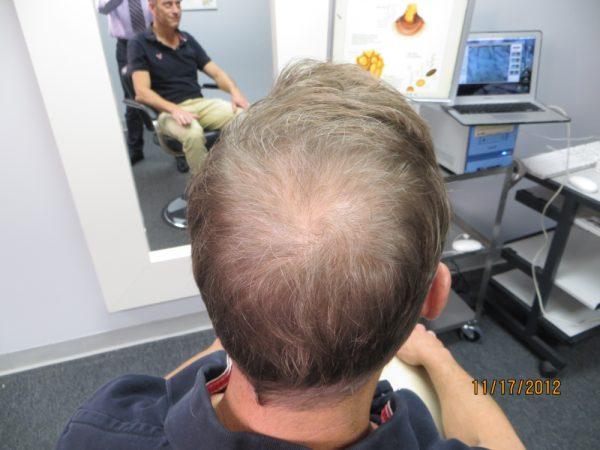 Chuck Edger’s Son Notices His Thickening Hair