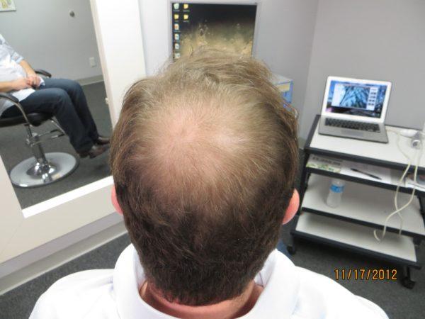 Dustin Burrow’s Hair is Growing