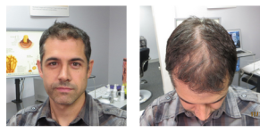 John Acosta – Baseline