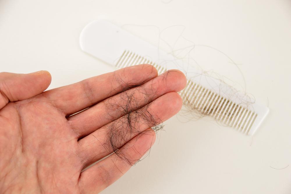 Losing Hair Using ScalpMED?