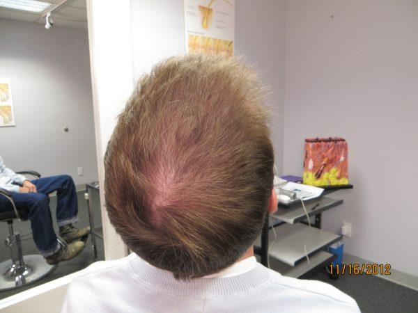 Marc Mahoney Can See His Hair Growing