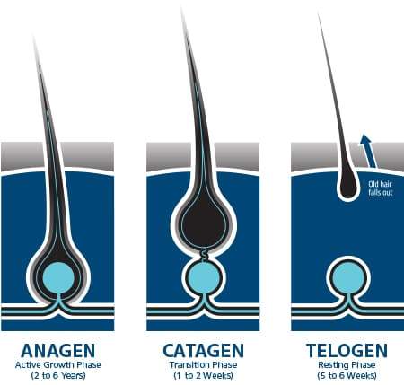 Telogen Effluvium Hair Regrowth