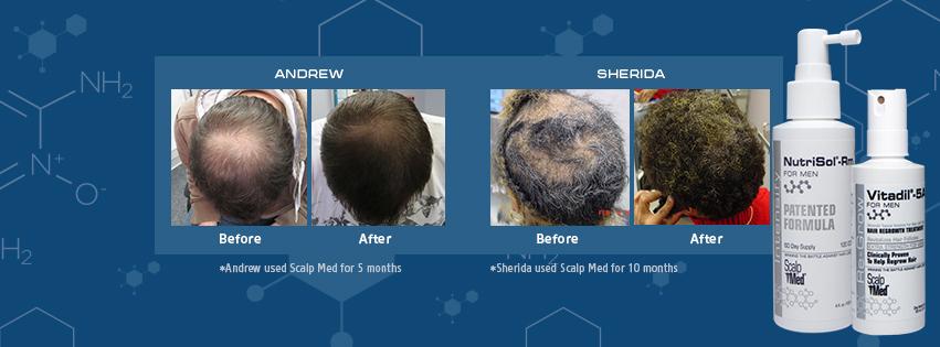 Scalp Med: Before & After Photos