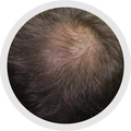 3 - 4 Months progress 1