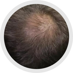 3 - 4 Months progress 1