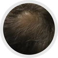 5 - 6 Months progress 1