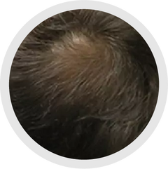 5 - 6 Months progress 1
