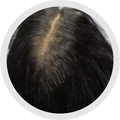 5 - 6 Months progress 2