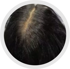5 - 6 Months progress 2