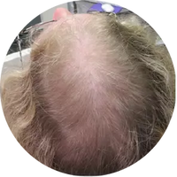 Day 1