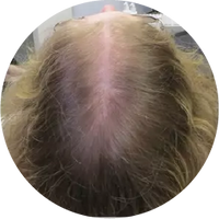 Month 2