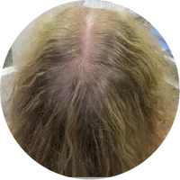 Month 4
